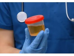 尿中有機(jī)酸的測定 氣相色譜-質(zhì)譜法 東西分析GC-MS 3250型